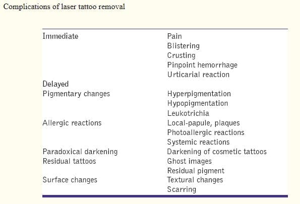 ProsCons of a tattoo  rChristianity