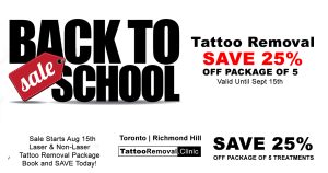 tattoo removal toronto - laser tattoo removal