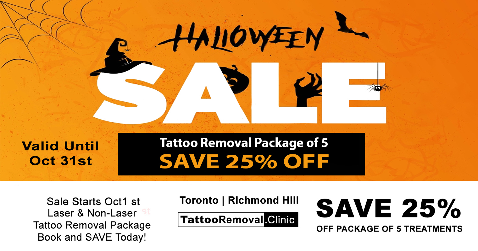 laser tattoo removal Toronto - laser tattoo removal before and after