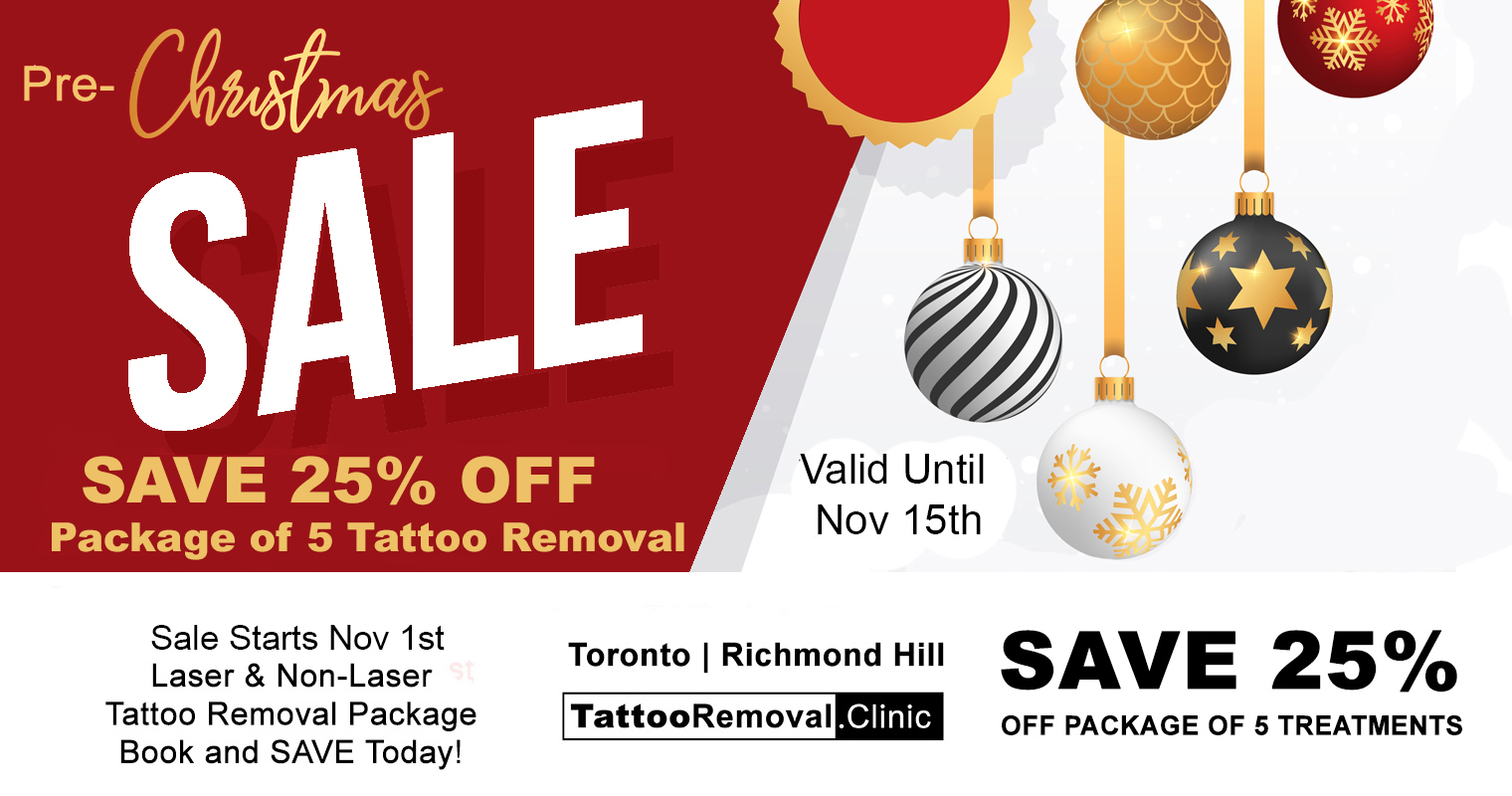 laser tattoo removal Toronto