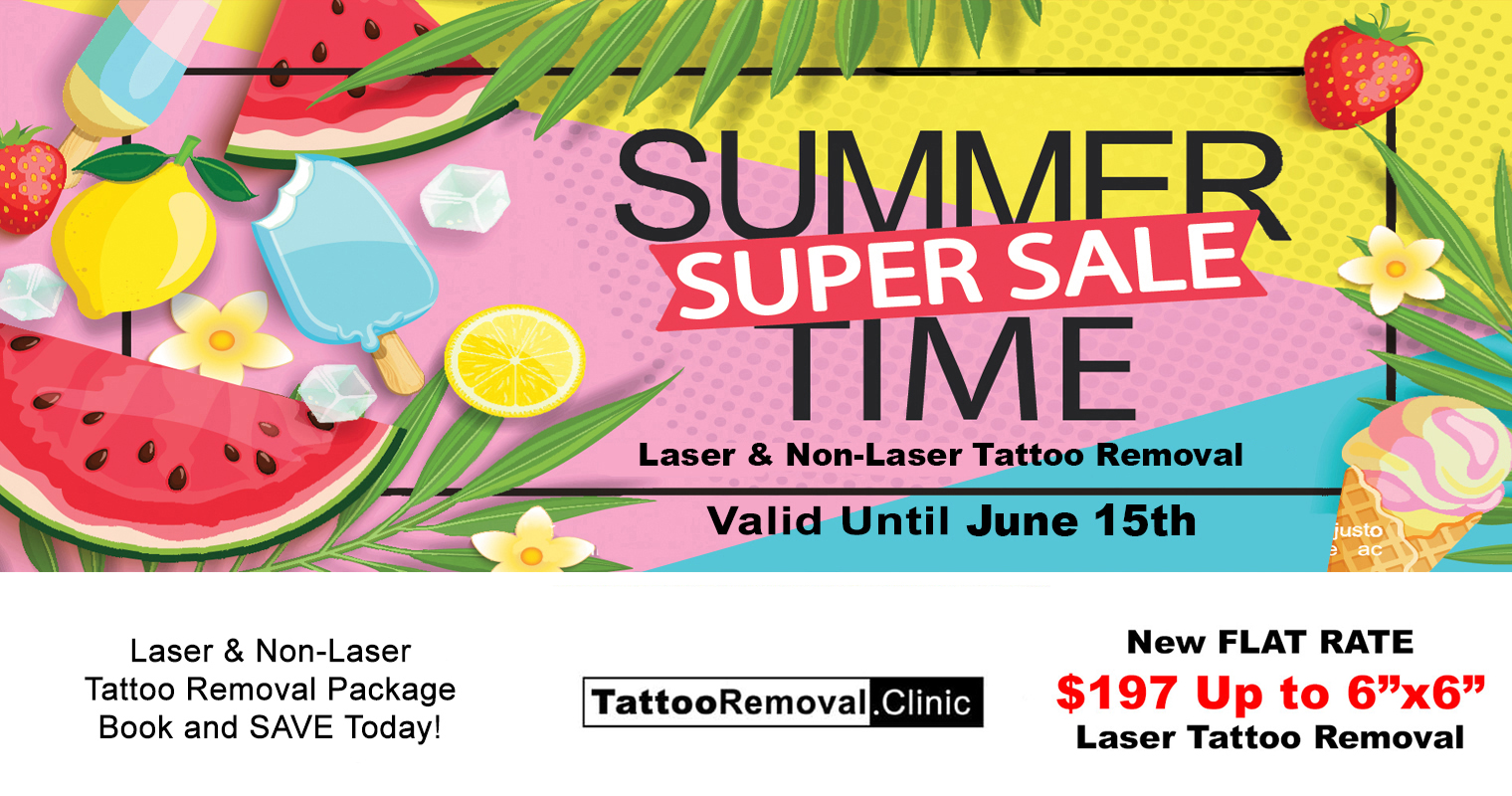 laser-tattoo-removal---tattoo-removal-clinic
